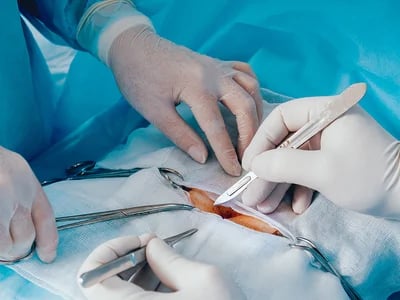 Magenverkleinerung Türkei – Entdecken Sie die beste Adipositas-Klinik für sichere Gewichtsabnahme