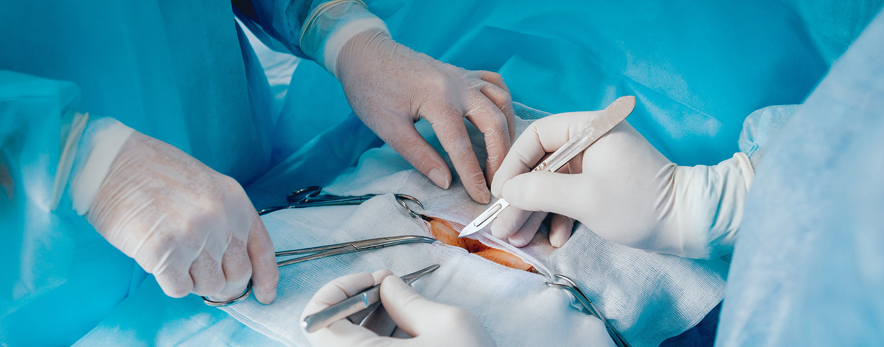 Magenverkleinerung Türkei – Entdecken Sie die beste Adipositas-Klinik für sichere Gewichtsabnahme