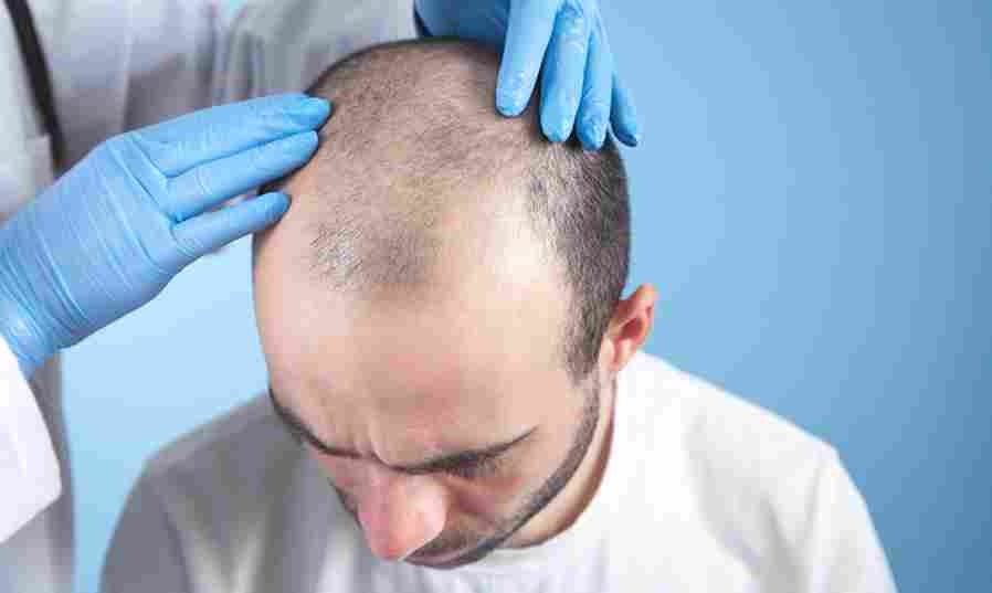 Hair Transplant Turkey: Discover the Best Clinics for 2025